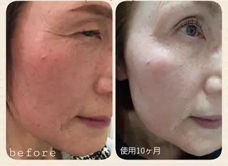 ruby cell hue.のその他イメージ