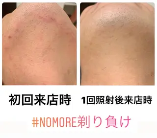 メンズ脱毛サロン Le falcoのエステ・リラクイメージ