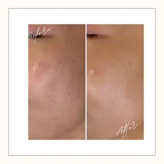 écla【中崎町】 yukikoのエステ・リラクイメージ