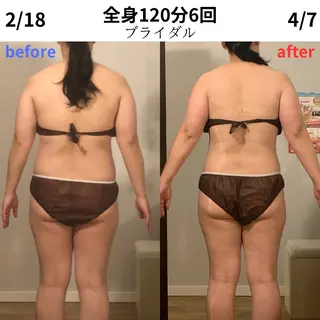 小顔・痩身専門店 Sunao所属・小顔.足痩せ整体 痩身天六Sunaoのその他イメージ