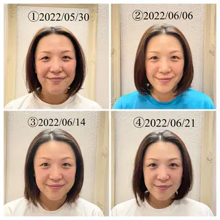 美容鍼　蒼月-aotsuki-所属・美容鍼「蒼月」 -アオツキ-のエステ・リラクイメージ