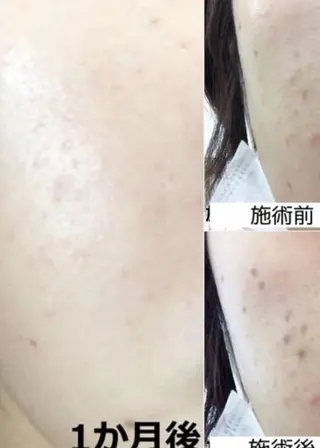 シミケア＆脱毛サロン CHANCEのエステ・リラクイメージ