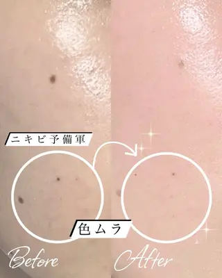 abbellina×UNO出雲塩冶店《ウノ》所属・フェイシャルエステ 🫧琉衣のエステ・リラクイメージ