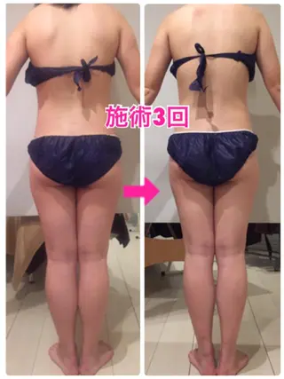 ショート カラー パーマ ヘアアレンジ メンズ キッズ ネイル マツエク・マツパ ‍痩身＆ボディ 結果出し🌟丹野のエステ・リラクイメージ