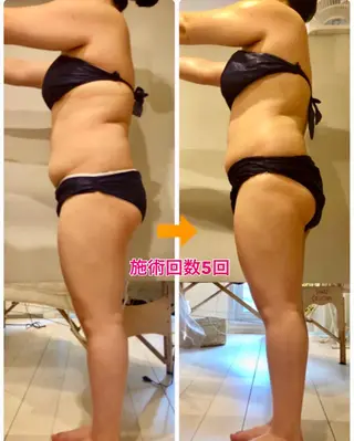 ショート カラー パーマ ヘアアレンジ メンズ キッズ ネイル マツエク・マツパ ‍痩身＆ボディ 結果出し🌟丹野のエステ・リラクイメージ