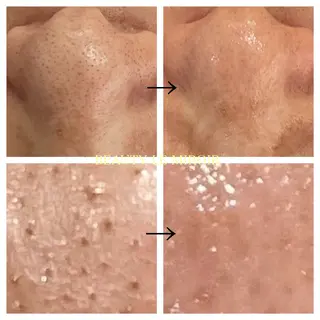 ビューティー ミロワールのエステ・リラクイメージ