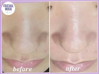 facial salon Lily所属・salon Lilyのエステ・リラクイメージ