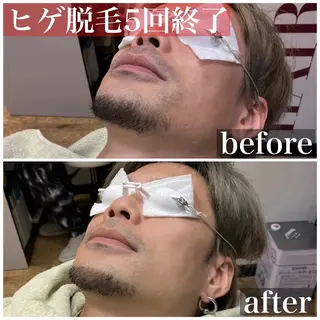 メンズ HAIRS YOSHIOKA所属・ヘアーズヨシオカ MENSヒゲ脱毛のエステ・リラクイメージ