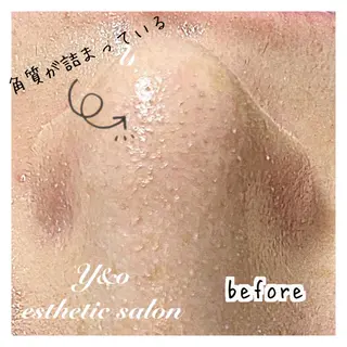 〜小顔・痩身・リラクゼーション〜　　Y&o Esthetic  Salon所属・HANA MIKIの眉毛・アイブロウイメージ