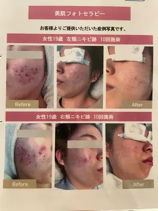 nail salon booのネイルデザイン