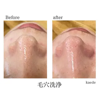 🎀kaede🎀 骨格似合わせ眉毛の眉毛・アイブロウイメージ