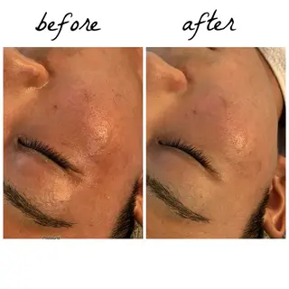 メンズ メナード岐阜市茜部 杉浦のエステ・リラクイメージ