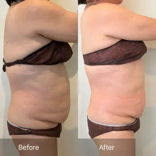 Charis エステ&ネイルのエステ・リラクイメージ