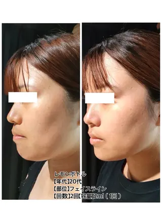 BeautySalonGemmy所属・Gemmy 愛美のエステ・リラクイメージ