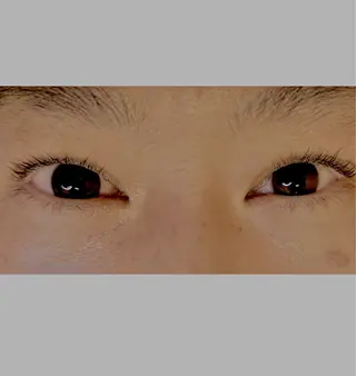 マツエク・マツパ soposilma 🧸今季OPENのマツエク・マツパデザイン