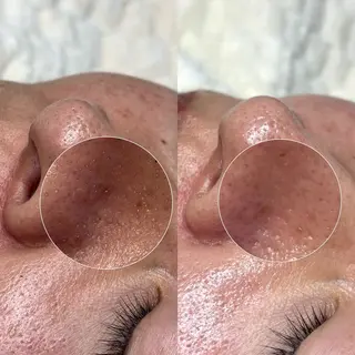 メンズ Suu.今池/千種 メンズ眉毛の眉毛・アイブロウイメージ