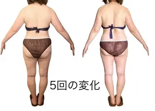 ラジオ波×リリース リラク★痩身MISAのエステ・リラクイメージ