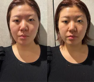 鍼灸サロン mahorobaトモのエステ・リラクイメージ