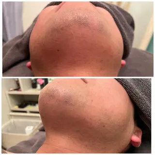 食べながら魅せボディ éclatJua川越のエステ・リラクイメージ