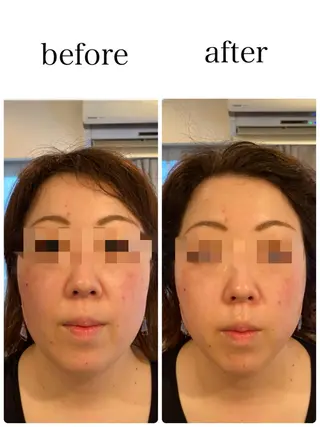 姿勢改善&beauty salon LAUB所属・姿勢改善 サロンLAUB奥村のエステ・リラクイメージ