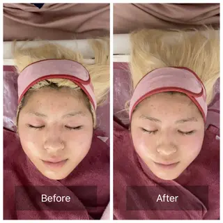 ♡Bivi♡自爪に 優しいネイルサロンのネイルデザイン