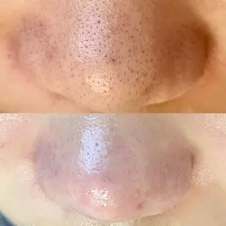 アイラッシュサロン CoCoのマツエク・マツパデザイン