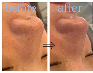 リジュベ所属・Rejuve ﾘｼﾞｭﾍﾞのエステ・リラクイメージ