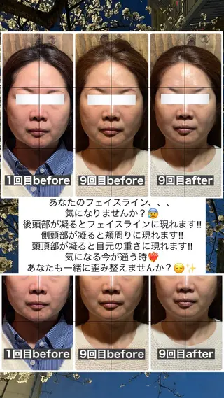 💎後悔させない小顔 矯正💎イトヤマ🌱のエステ・リラクイメージ