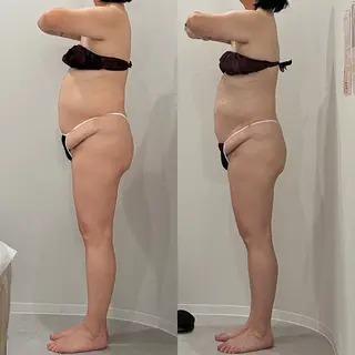 美容整体エステ　Asmy神戸板宿店所属・美容整体エステ ASMY神戸板宿店のエステ・リラクイメージ