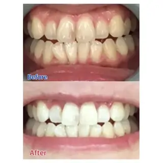 M渋谷店所属・M渋谷 ホワイトニングのエステ・リラクイメージ