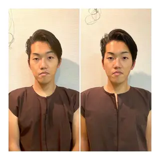 即小顔♥️美容鍼× ハーブピーリングのその他イメージ