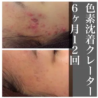 ミディアム カラー パーマ ヘアアレンジ メンズ キッズ ネイル マツエク・マツパ ニキビ・肌質改善専門 ♡人生が変わるサロンのエステ・リラクイメージ