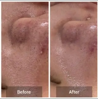 メンズ MARIRE EPISALONのエステ・リラクイメージ