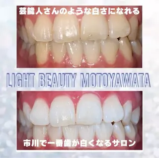 五十嵐 蓮のその他イメージ