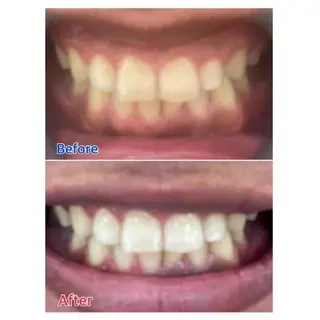 M渋谷店所属・Ｍ渋谷 ホワイトニングのエステ・リラクイメージ