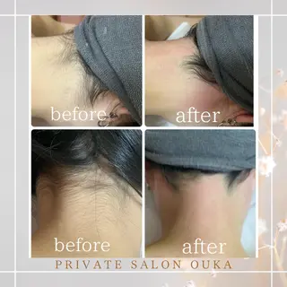private salon OUKA所属・OUKA脱毛 毛穴ケアフェイシャルのエステ・リラクイメージ