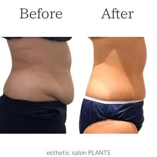esthetic salon PLANTS所属・エステティックサロン PLANTSのエステ・リラクイメージ