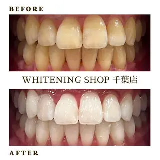 メンズ ホワイトニング ショップ千葉店のその他イメージ