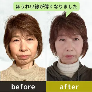 ヘイワポッド所属・小顔&ヘッドスパ/ もりもとまきみのエステ・リラクイメージ