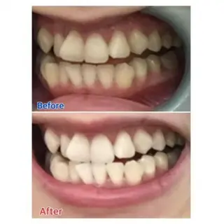 M渋谷店所属・Ｍ渋谷 ホワイトニングのエステ・リラクイメージ