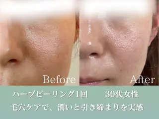 潤い艶肌／肌質改善 YUKAのエステ・リラクイメージ