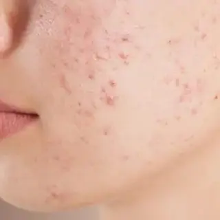 メンズ private salon meのエステ・リラクイメージ