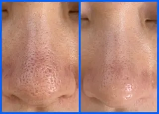 メンズ private salon Aola所属・プライベートサロン アオラのネイルデザイン