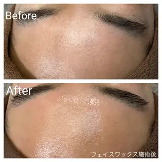 深い肌悩み専門 フェイシャルサロンのエステ・リラクイメージ