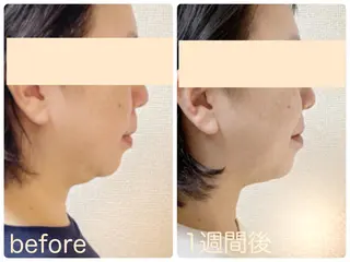 小顔矯正サロン　クレール所属・小顔矯正専門サロン クレールのエステ・リラクイメージ