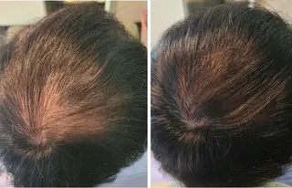 メンズ GRAZIE所属・分け目・つむじ 自然増毛専門のヘアスタイル