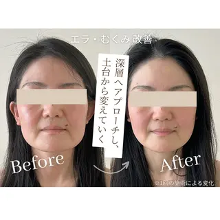 小顔コルギSalon de ETULEのエステ・リラクイメージ