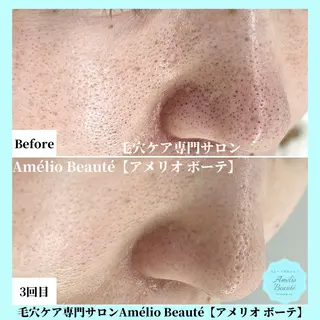 毛穴ケア専門サロン Amélio Beauté所属・毛穴ケア専門サロン アメリオボーテのその他イメージ