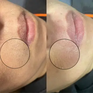 yume   eyelash所属・yumeka 【eyelash】のマツエク・マツパデザイン