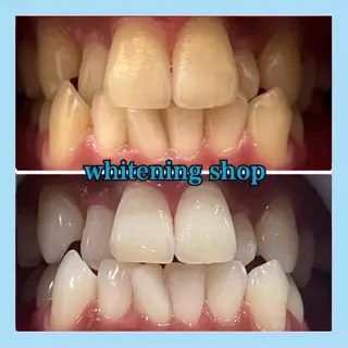 ホワイトニング ショップ千葉店のその他イメージ